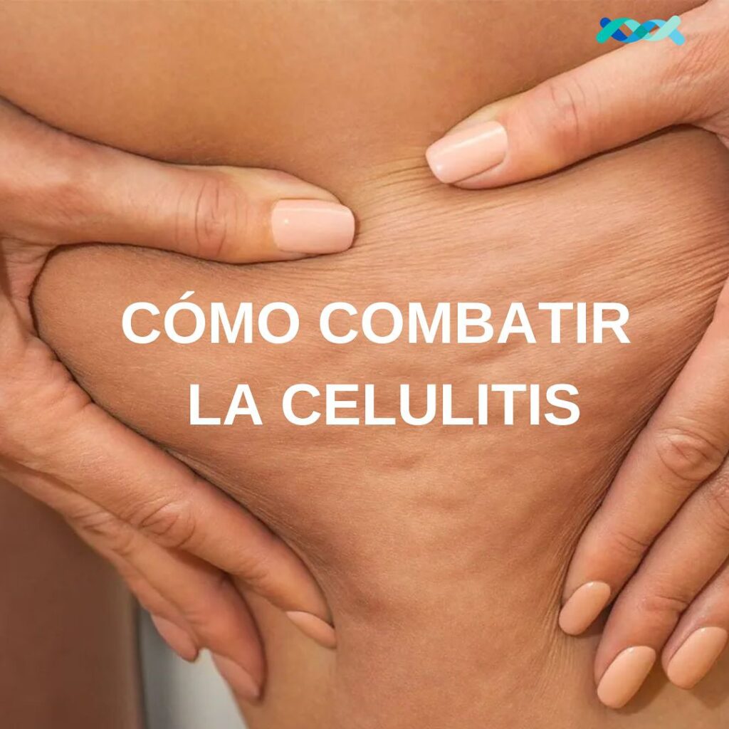 Celulitis Blog